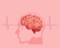 Clogged Arteries in the Brain (Stroke): Causes, Risk Factors, and Treatment