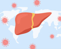 Viral Hepatitis: Types, Symptoms and Prevention