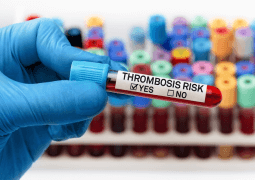 best hospital for treating thrombocytopenia in Raipur
