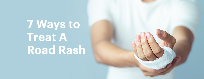 7 Ways to Treat A Road Rash