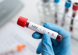 एचआयव्ही आणि एड्स: लक्षणे, कारणे, प्रतिबंध आणि उपचार