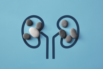 Basic Kidney Stone Health Check-up Package in Outpatient Centre, Banjara Hills