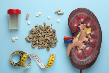 Advanced Kidney Stone Health Check Up Package in Outpatient Centre
