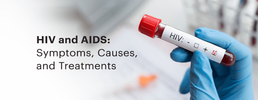 HIV and AIDS: Symptoms, Causes, and Treatments