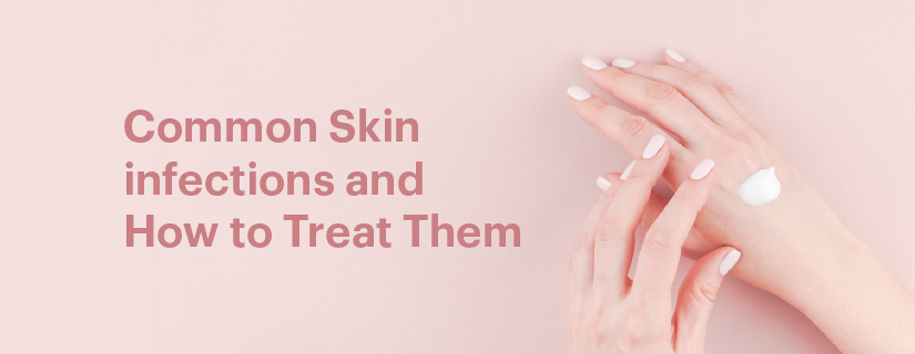 Common Skin infections and How to Treat Them