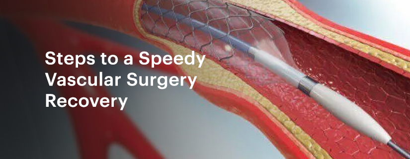 Steps to a Speedy Vascular Surgery Recovery
