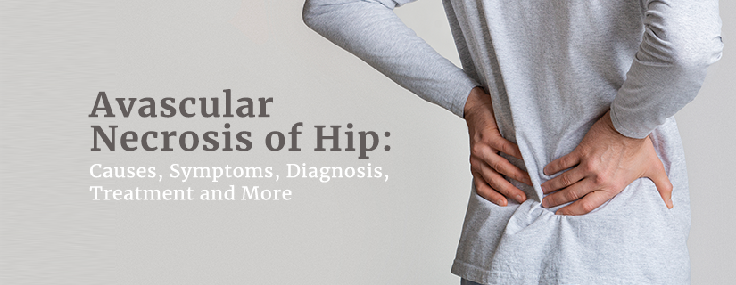 Avascular Necrosis of the Hip (AVN): Causes, Symptoms, Treatment & Prevention