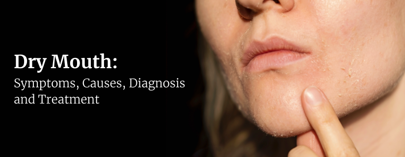 शुष्क मुँह: लक्षण, कारण, निदान और उपचार