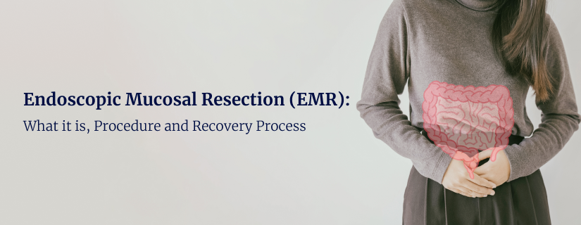 Endoscopic Mucosal Resection (EMR)