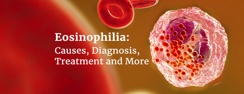 Eosinophilia: Causes, Diagnosis, Treatment and More