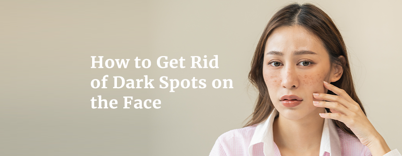 How to Get Rid of Dark Spots on the Face	