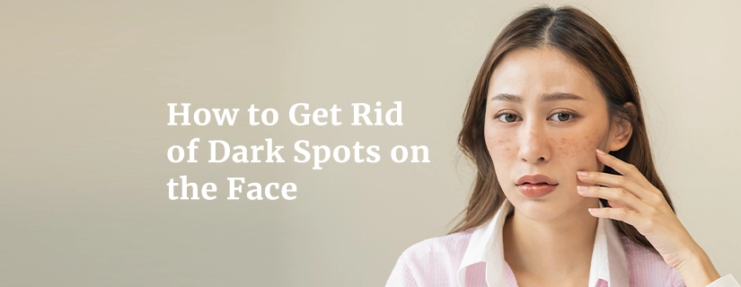 Dark spots on the skin: Causes, treatments, and remedies