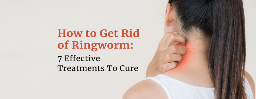 How to Get Rid of Ringworm: 7 Effective Treatments To Cure