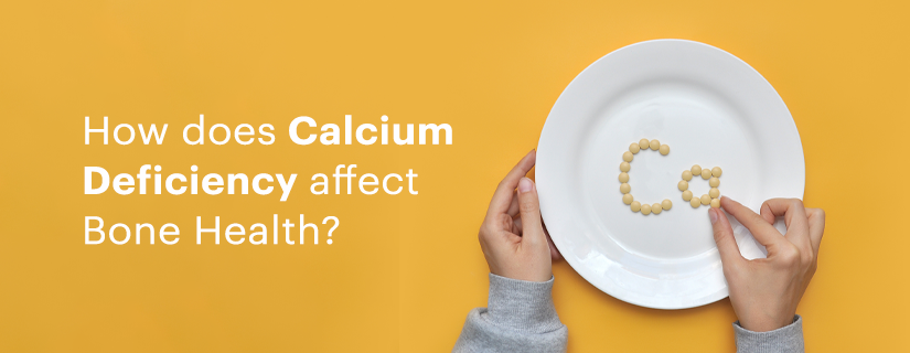 Sidee bay u yarayn Calcium u saamaysaa caafimaadka lafaha?