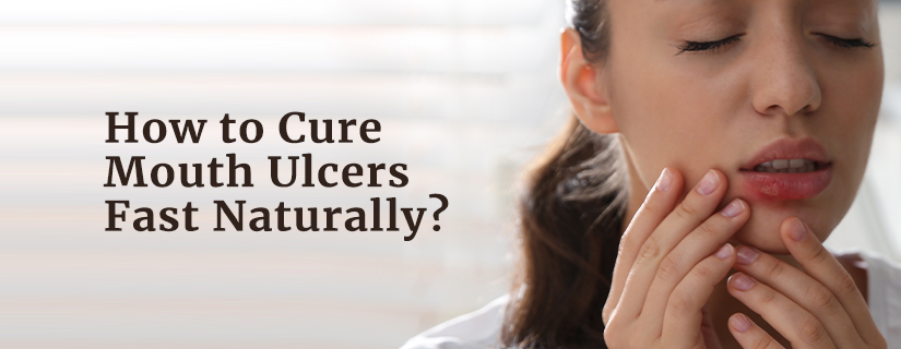 12 Natural Remedies To Cure Mouth Ulcers