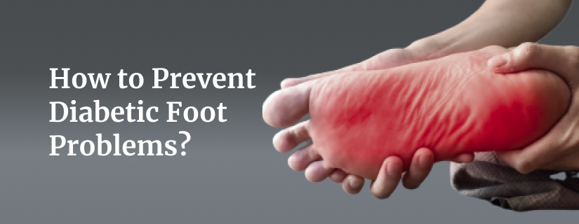 How to Prevent Diabetic Foot Problems?