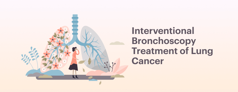 Interventional Bronchoscopy Treatment of Lung Cancer