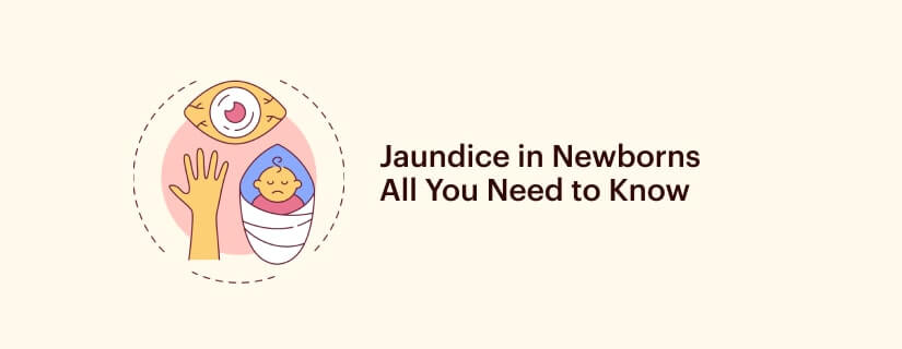 Symptoms, Causes, and treatment options of Jaundice in Newborns