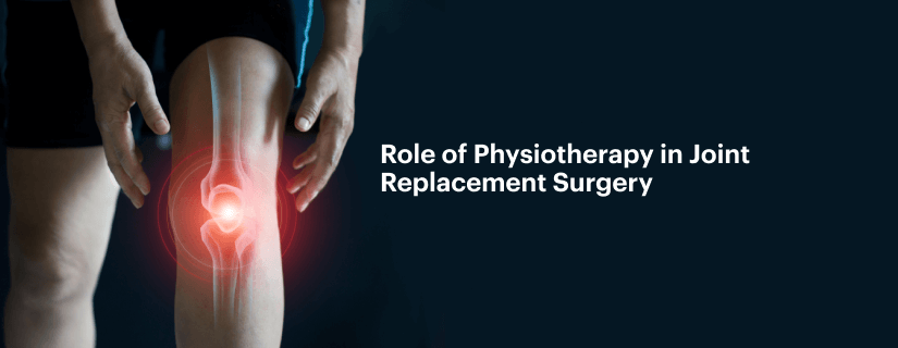 Role of Physiotherapy in Joint Replacement Surgery