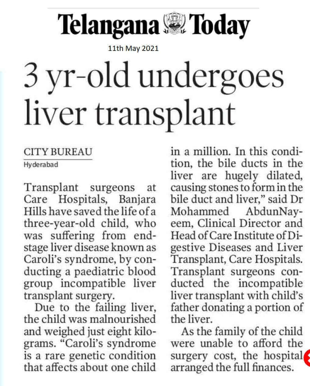 3-Year-old Undergoes Liver Transplant by  Dr. Mohammed Abdun Nayeem - Clinical Director & HOD - CARE Institute of Digestive Diseases & Liver Transplant