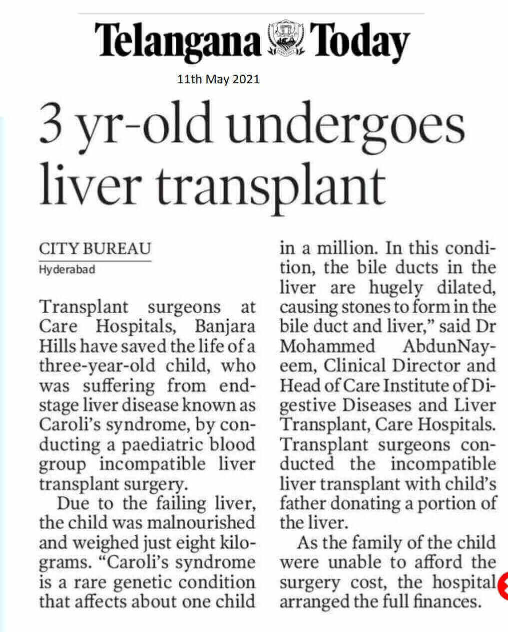 3-Year-old Undergoes Liver Transplant by  Dr. Mohammed Abdun Nayeem - Clinical Director & HOD - CARE Institute of Digestive Diseases & Liver Transplant by Telungana Today