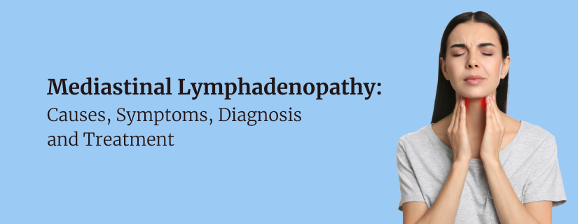 Dhexdhexaadiyaha Lymphadenopathy