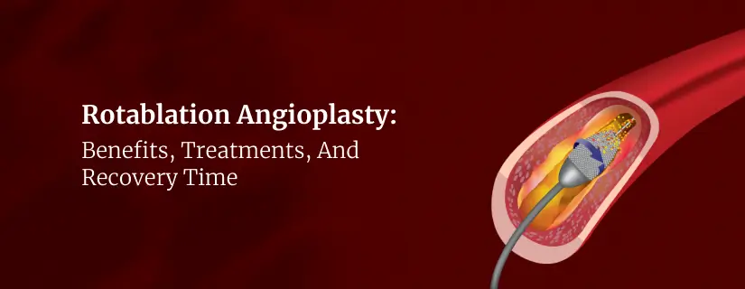 Rotablation Angioplasty