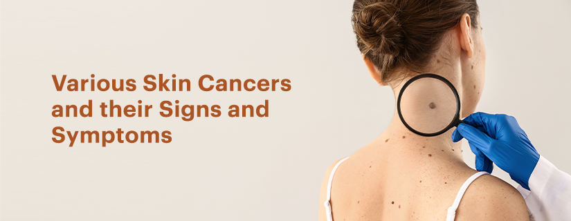 Various Skin Cancers and their Signs and Symptoms