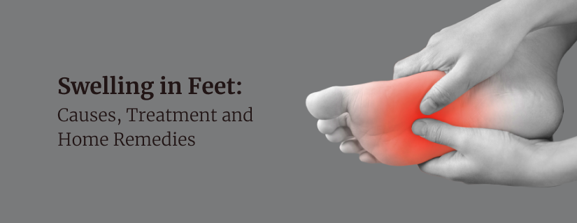 Swollen soles of feet causes hotsell