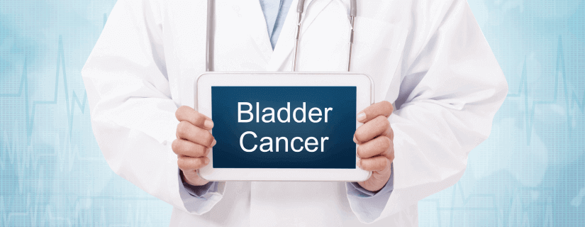 Bladder Cancer Treatment: Here’s All You Need to Know