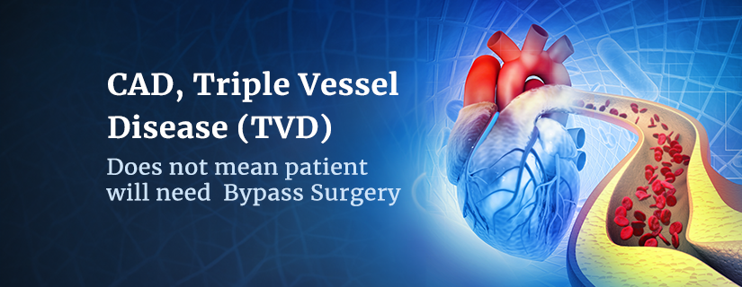 CAD, Triple Vessel Disease (TVD) Does Not Mean the Patient Will Need Bypass Surgery