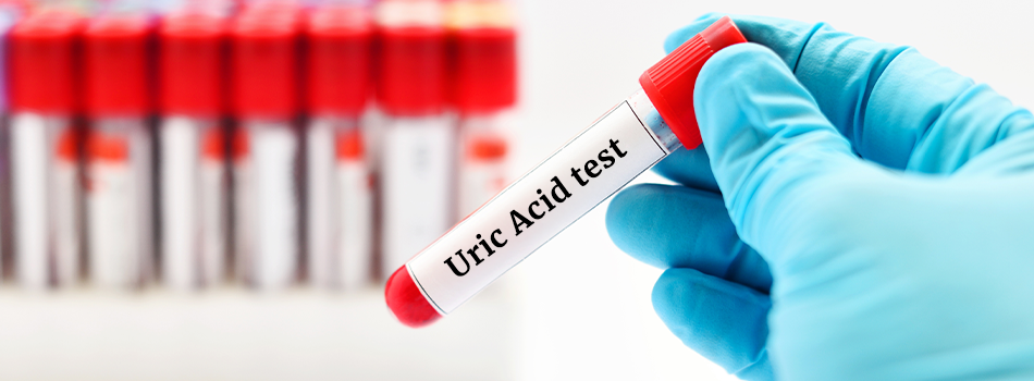 How to Reduce Uric Acid Levels?