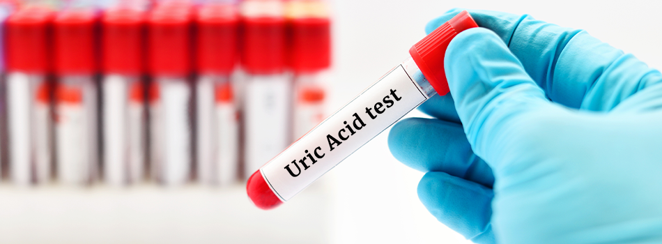 Uric Acid in Body