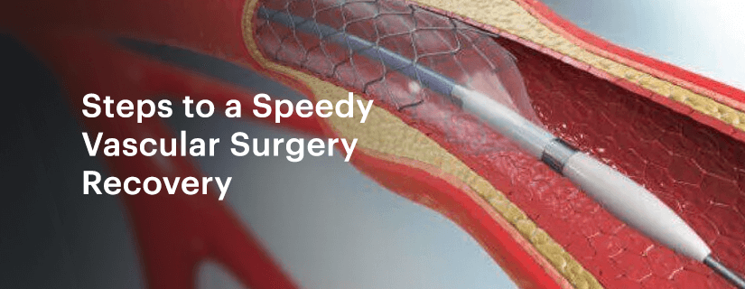 Steps to a Speedy Vascular Surgery Recovery