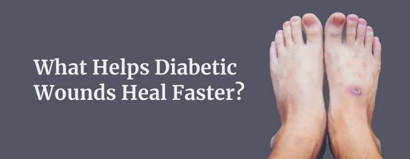 Diabetes and Feet – Plantar Warts