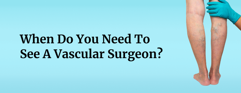 When Do You Need To See A Vascular Surgeon?