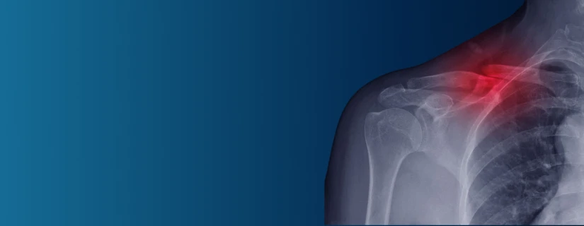 pain banner