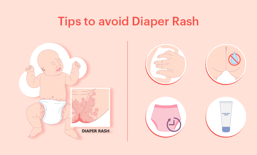 Tips to avoid Diaper Rashes