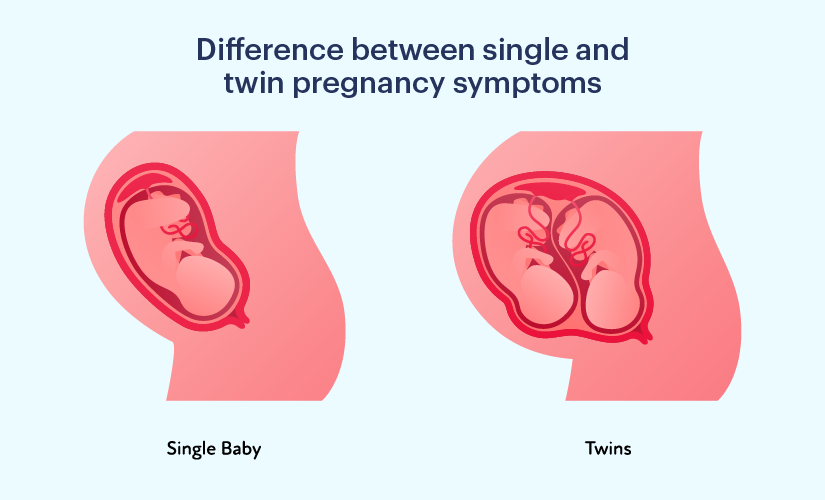 Difference Between Single and Twin Pregnancy: Symptoms And Tips During  Pregnancy