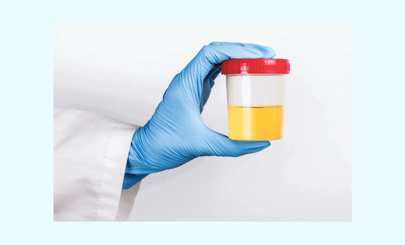 Leukocytes in Urine While Pregnant: Causes & Treatment
