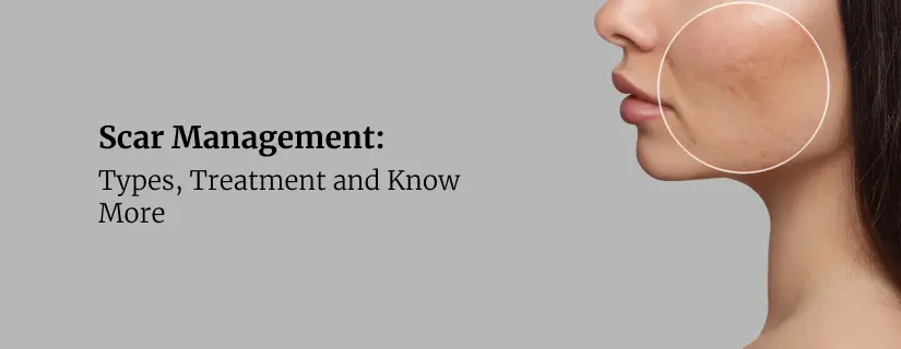 Scar Management: Types, Treatment and Know More